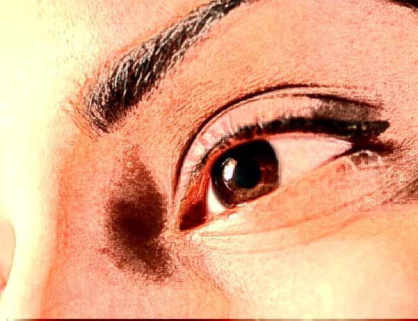 2024杭州開外眼角價(jià)格表?杭州開外眼角哪家醫(yī)院好?