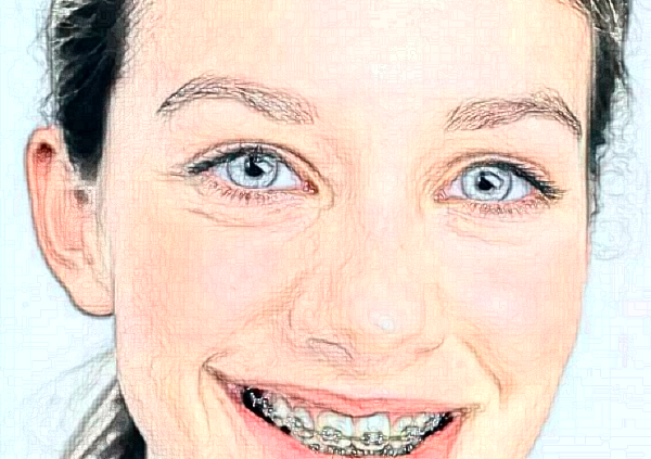 淮北頜面正畸價格表?頜面正畸哪個醫(yī)院好