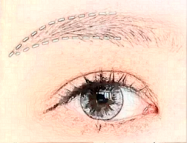 常州豐眉弓需要多少錢?豐眉弓用什么材料好?