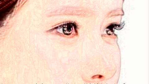 2024鞍鼻矯正價(jià)格表_鞍鼻矯正需要住院嗎