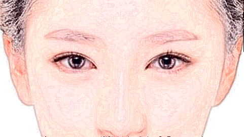 玻尿酸豐太陽(yáng)穴危險(xiǎn)嗎_2024玻尿酸豐太陽(yáng)穴價(jià)格表