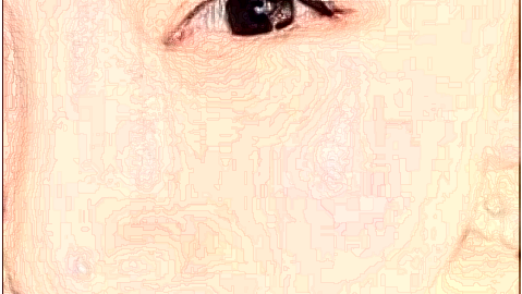 激光祛斑價(jià)目表公布_激光祛斑的副作用