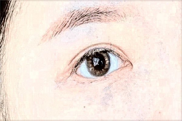 2024上瞼提肌的價(jià)格表(10月更新)_上瞼提肌后遺癥