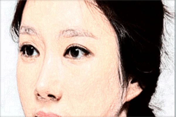 南醫(yī)大友誼面部年輕化收費價格表(價目表)一覽