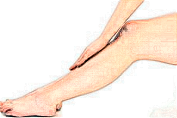 2024常州瘦小腿醫(yī)院哪家好_瘦小腿價(jià)目表公布