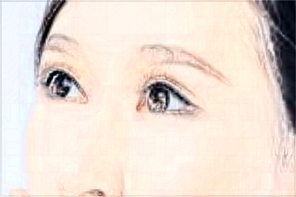 海口去眼袋那家醫(yī)院好_【附案例】