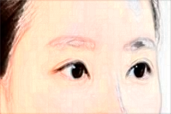 ?？谌パ鄞羌裔t(yī)院好_【附案例】