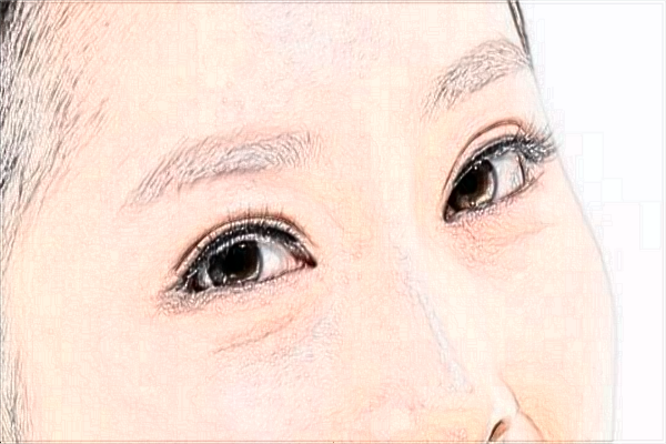 2024?？陔p眼皮醫(yī)院排名_【醫(yī)生推薦】