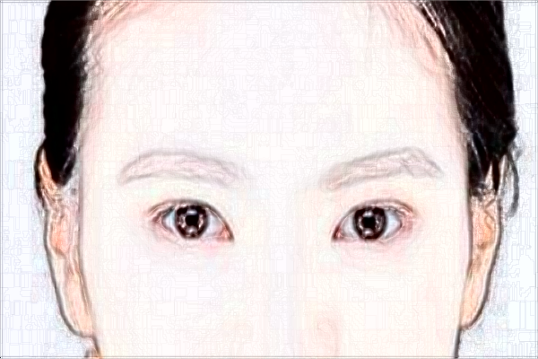 ?？谪S額頭價(jià)目表_醫(yī)院哪里好