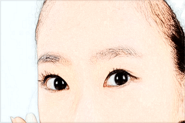 2024價格表公布_手術(shù)能夠維持幾年