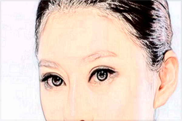 割雙眼皮和埋線哪個好?割雙眼皮和去眼袋哪個風(fēng)險大?