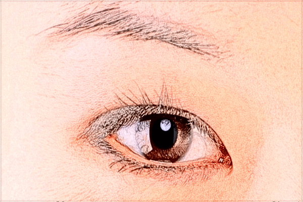 2024開(kāi)眼角價(jià)格表公布_開(kāi)眼角的危害有哪些