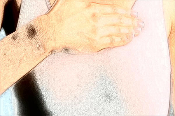 2024海口隆胸價目表_附醫(yī)院推薦