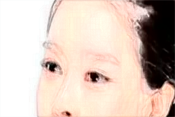 2024割雙眼皮價目表公布_割雙眼皮大概多久能恢復正常