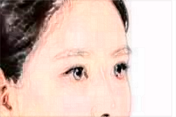 2024埋線雙眼皮價(jià)目表公布_埋線雙眼皮的危害性