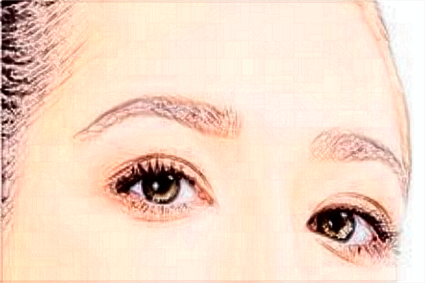 割雙眼皮需要多少錢一次?割雙眼皮需要恢復(fù)多長時間?