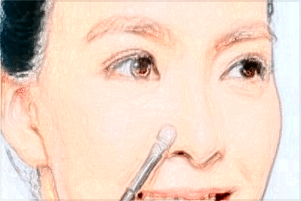 耳垂矯正價格表_垂耳矯正后還會垂下來嗎