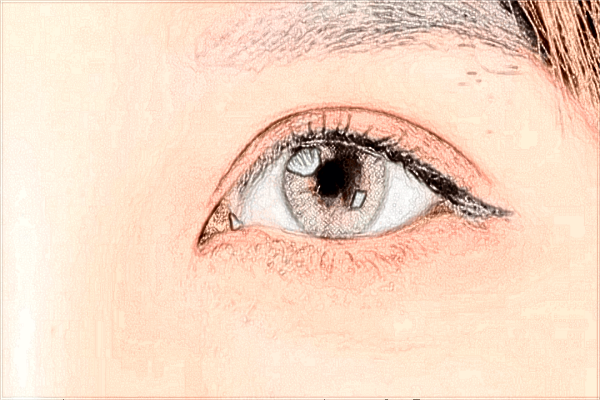 2024上海割雙眼皮價格表_上海割雙眼皮三甲醫(yī)院