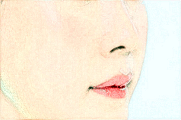 唇裂修復(fù)價(jià)格表_唇裂修復(fù)術(shù)的佳年齡