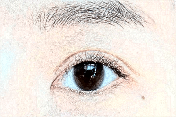 割雙眼皮需要住院?jiǎn)?割雙眼皮需要打麻藥嗎?