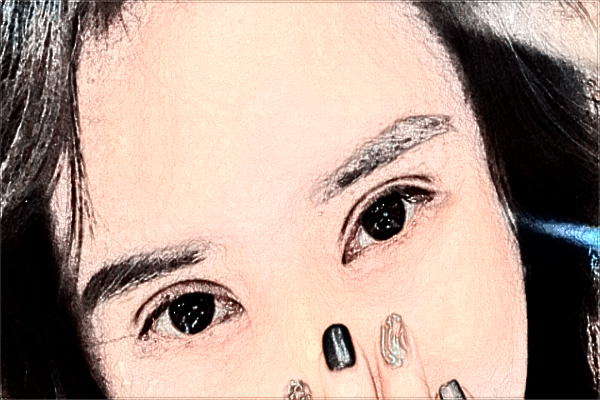 割雙眼皮需要住院?jiǎn)?割雙眼皮需要打麻藥嗎?