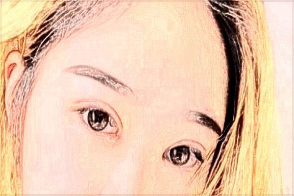 割雙眼皮做哪種比較好?割雙眼皮做提肌和不做的區(qū)別?