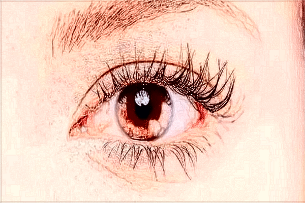 義烏內切去眼袋怎么樣_醫(yī)院哪里好