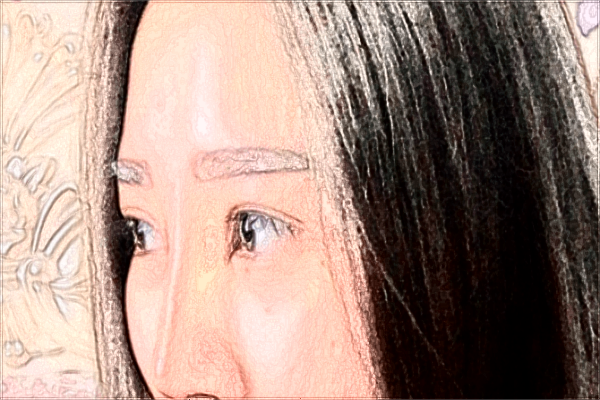 義烏去眉間紋醫(yī)院推薦_哪位醫(yī)生好