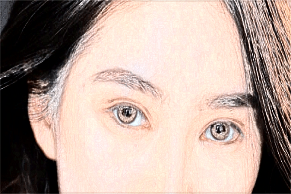 2024濟南雙眼皮整形醫(yī)院排名_附雙眼皮案例