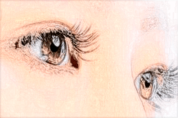 2024北京蒂凡妮割雙眼皮價格表(價目表)搶先看