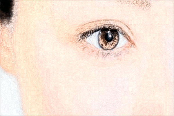 2024北京禾美嘉玻尿酸價(jià)格表(價(jià)目表)怎么樣