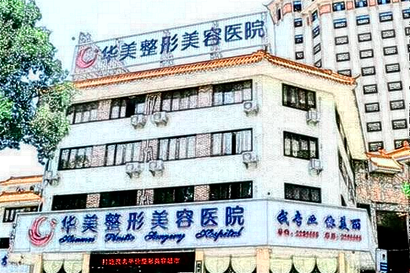 2024潮州華美割雙眼皮怎么樣_割雙眼皮價(jià)目表