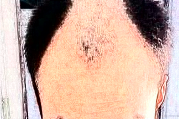 四川米蘭柏羽植發(fā)好不好?2024收費(fèi)價(jià)格表