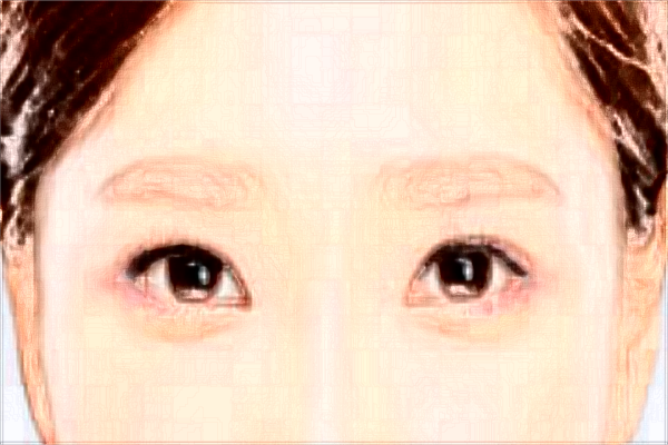 北京割眼袋那家醫(yī)院比較好_技術(shù)怎么樣