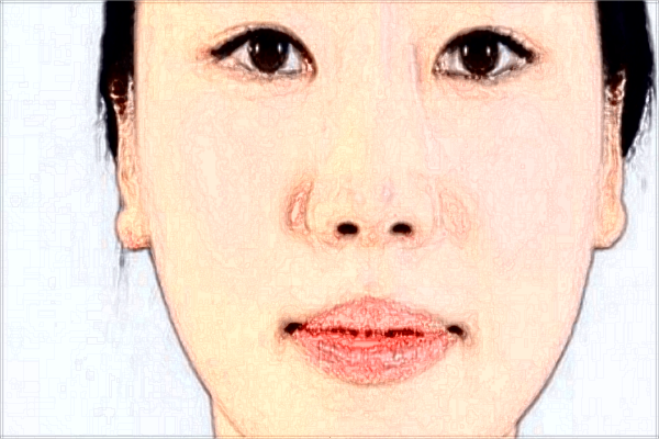 四川米蘭柏羽熱瑪吉貴嗎?熱瑪吉收費(fèi)價(jià)目表