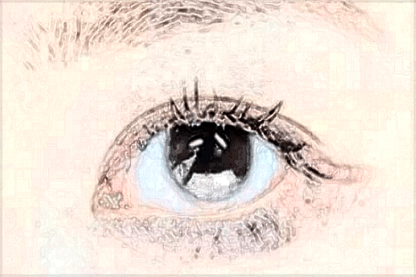 激光去眼袋的價(jià)目表_激光去眼袋的危害和效果