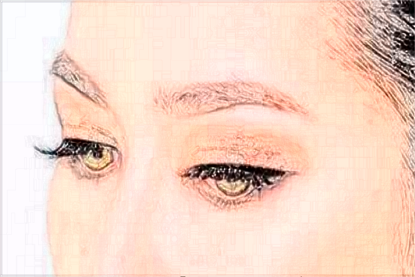 2024北京協(xié)和醫(yī)院做雙眼皮大概多少錢_附醫(yī)生名單