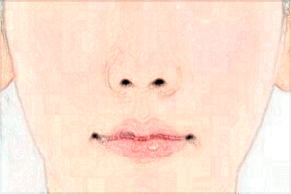 2024北京協(xié)和醫(yī)院隆鼻大概多少錢_附醫(yī)生名單