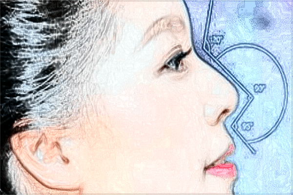 2024上海時光整形醫(yī)院假體隆鼻怎么樣_哪位醫(yī)生技術(shù)好