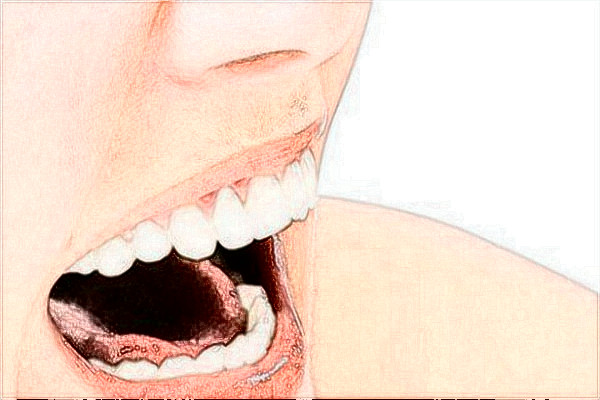 吉林市中心醫(yī)院種植牙怎么樣?種植牙多少錢