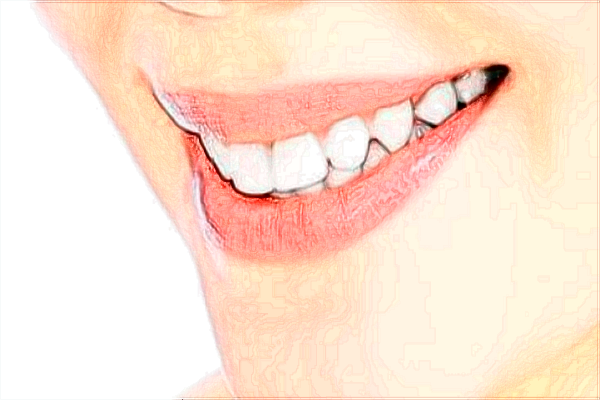 2024上海前牙種植價(jià)目表(價(jià)格表)曝光_醫(yī)院哪家好