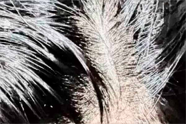 上海長征醫(yī)院種發(fā)際線收費(fèi)價(jià)格_種發(fā)際線怎么樣