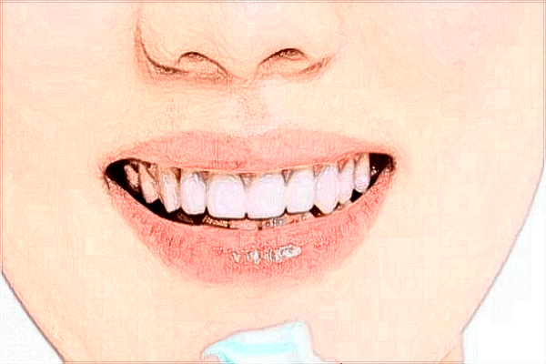 北京中醫(yī)醫(yī)院烤瓷牙補(bǔ)牙多少錢_哪位醫(yī)生技術(shù)比較好