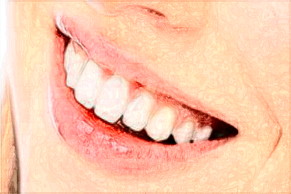 北京中醫(yī)醫(yī)院全口牙種植多少錢_哪位醫(yī)生技術(shù)比較好