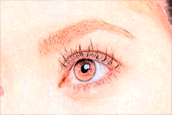 北京藝美做雙眼皮價目表(價格表)怎么樣