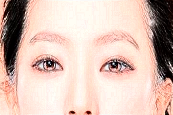 重慶聯(lián)合麗格去淚溝好不好_醫(yī)生名單