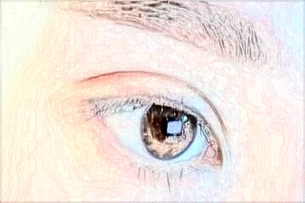 北京雙眼皮醫(yī)院排名_附醫(yī)生名單