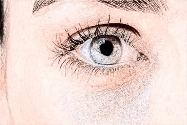 2024浙江醫(yī)院切開雙眼皮價格表(價目表)一覽