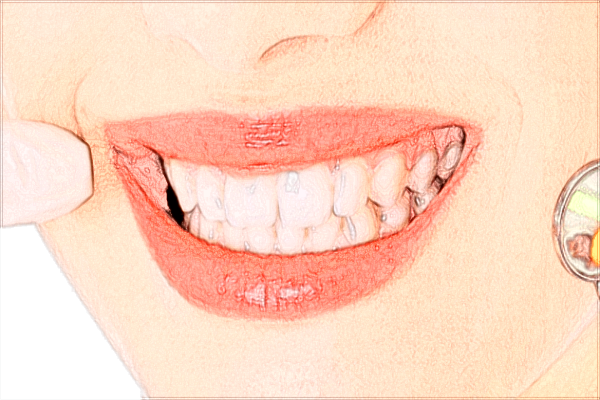 2024重慶市第一人民醫(yī)院口腔科種植牙怎么樣_哪位醫(yī)生做得好