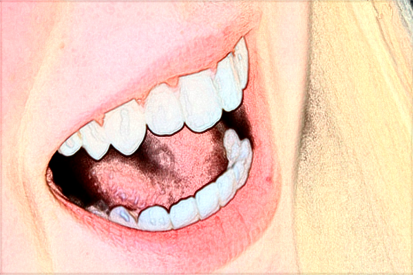 2024重慶解放軍324醫(yī)院口腔科前牙種植好不好_哪位醫(yī)生做的比較好